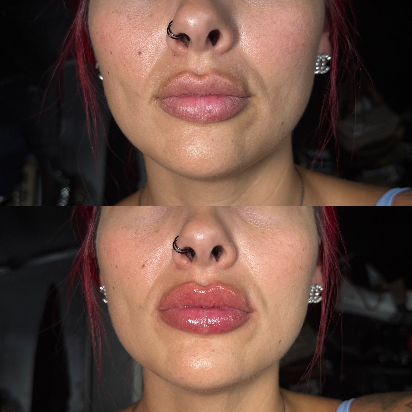 Lip Plumper