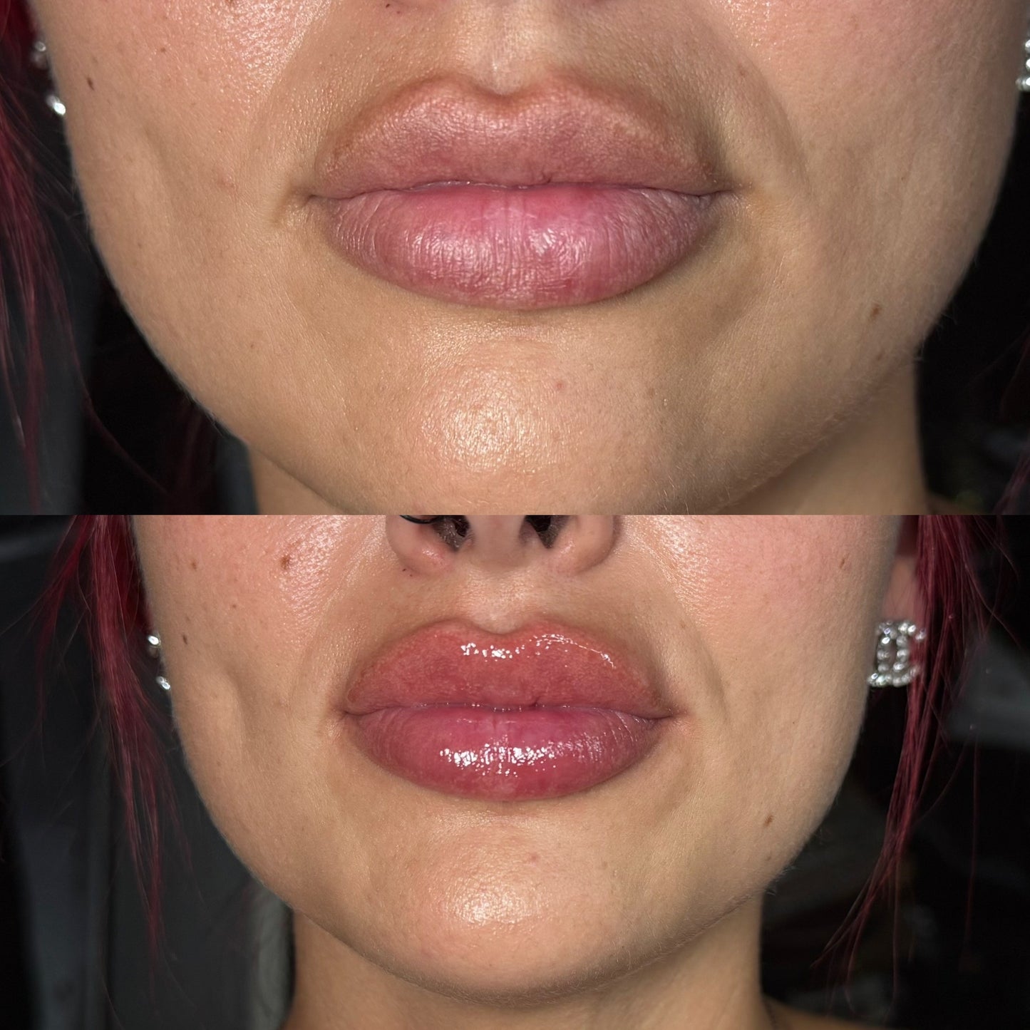 Lip Plumper